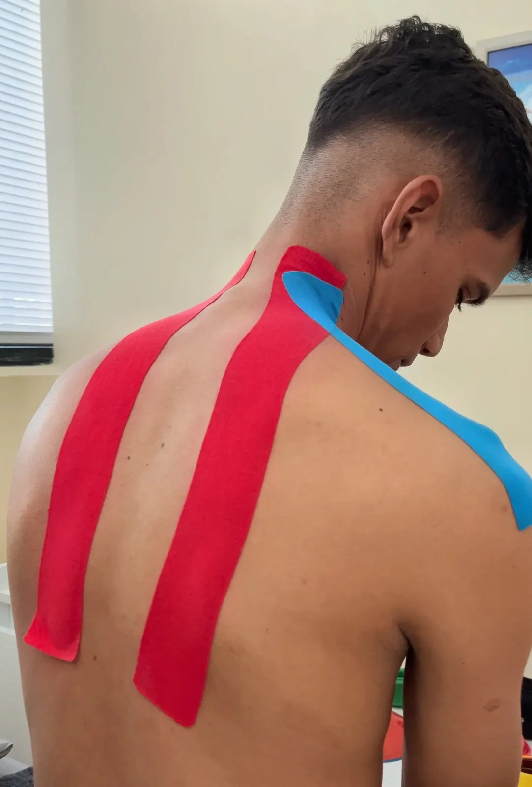 Kinesiotaping